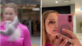 “¡Dios mío, mi ojo!”: Reportera fue golpeada por ave en el rostro, terminó sangrando y se hizo viral 