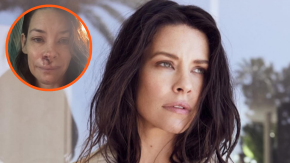 Evangeline Lilly, actriz de ‘Lost’ y ‘Ant-Man’, revela que tiene daño cerebral 