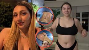 "¡Devoraste!": Carlita impacta con su cambio físico tras operación estética