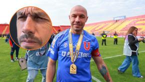 "Apariencia armónica y auténtica": Marcelo Díaz sorprende con nuevo tratamiento estético