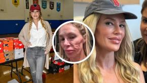 Impactante caso: Exmodelo asegura que implantes mamarios rotos le provocaron "parásito" que le deformó la cara