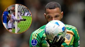 FOTO | Irreconocible: Así quedó el rostro de Everson tras la batalla campal en Brasil