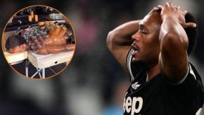 ¿Qué dicen los expertos?: El escalofriante tratamiento de ventosas de figura de la Juventus