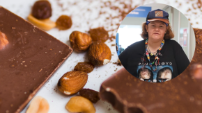 Mujer sufrió colapso pulmonar tras comer un chocolate con almendras: terminó en la UCI 