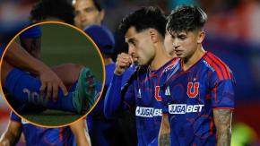 "Si el manejo previo no fue el adecuado...": Experto explica las múltiples lesiones que azotan a la U