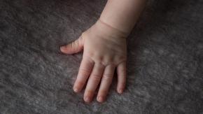 "Daño neurológico irreversible": Actualizan estado de salud de niño de 4 años electrocutado en La Serena