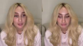 “Caí en un hoyo”: Fran Maira reaparece tras accidente de tránsito en Lo Barnechea donde motorista quedó grave