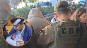 Denuncian golpiza de guardia a hombre neurodivergente en tienda de Concepción