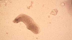 Incómodos compañeros de cama: el gusano que nos visita mientras dormimos