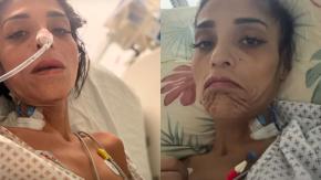 "Esto le puede pasar a cualquiera": Katherine Orellana reaparece tras grave complicación que la tuvo en riesgo vital