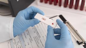 ISP emitió alerta por test rápido de VIH sin registro sanitario: cómo identificarlo y qué hacer si lo compré
