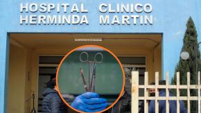 Denuncian grave negligencia en el hospital de Chillán: olvidaron pinza quirúrgica dentro de una paciente
