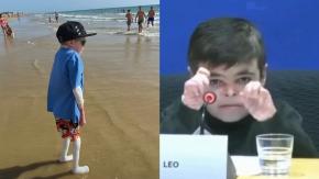 "Un ejemplo para el ser humano": Leo García, el niño con "piel de mariposa" que emocionó a Europa, sorprende con avance en tratamiento
