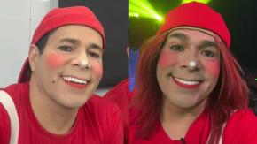 Pastelito sorprende tras aparecer con radical cambio de look antes de someterse a intervención estética