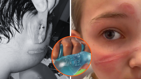 Alerta en EE.UU. por juguete que está causando graves quemaduras en niños: producto está disponible en Chile