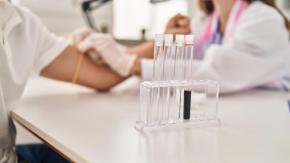 Los exámenes que probará el Minsal para detectar cáncer de manera temprana: ¿cómo funcionarán y a qué comunas estarán dirigidos?