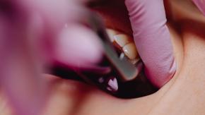 Herida que no cicatriza o ronquera persistente: Reconoce estas señales para detectar a tiempo un cáncer de cabeza y cuello