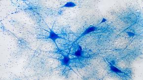 El Nobel que ilumina el cerebro: por qué la optogenética ha cambiado por completo la neurociencia
