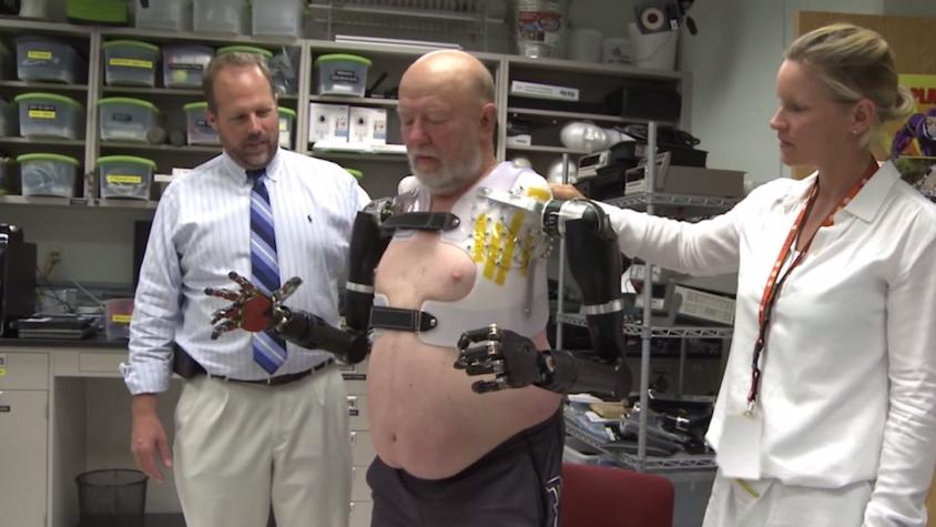 [VIDEO] 40 años después de perder sus 2 brazos este hombre manejó prótesis con el cerebro