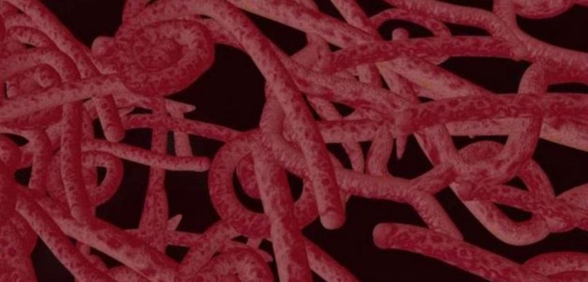 En estado crítico se encuentra enfermera británica contagiada con ébola