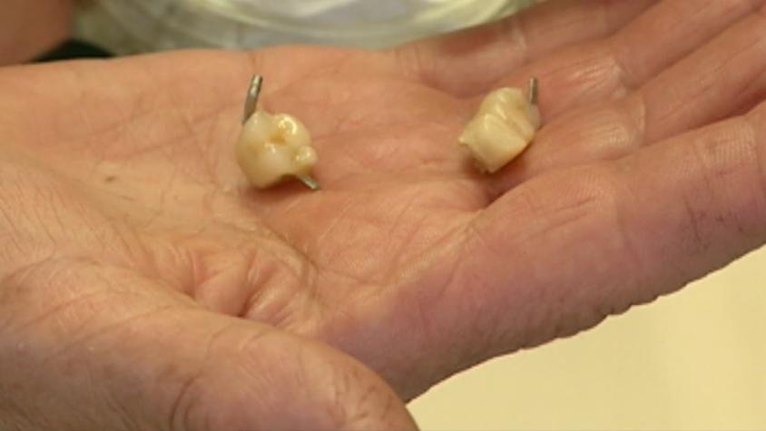 [T13] 17 serían las víctimas de un falso dentista formalizado por lesiones graves