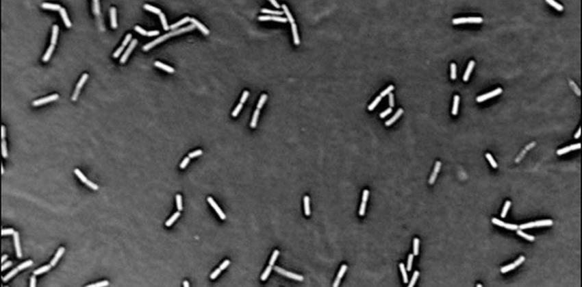 EEUU: hallan una bacteria mortal al exterior de laboratorio de alta seguridad