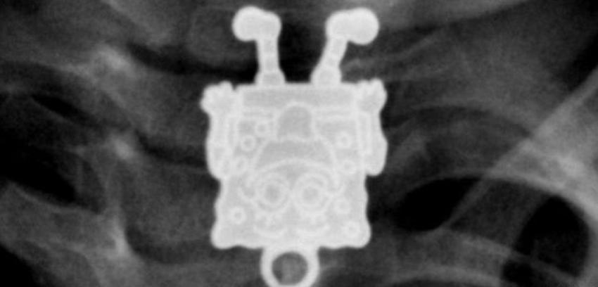 Las inusuales imágenes de rayos X compartidas por médicos
