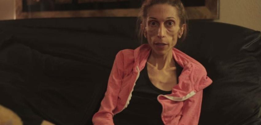 [Video] Actriz anoréxica pide ayuda en internet para superar su enfermedad