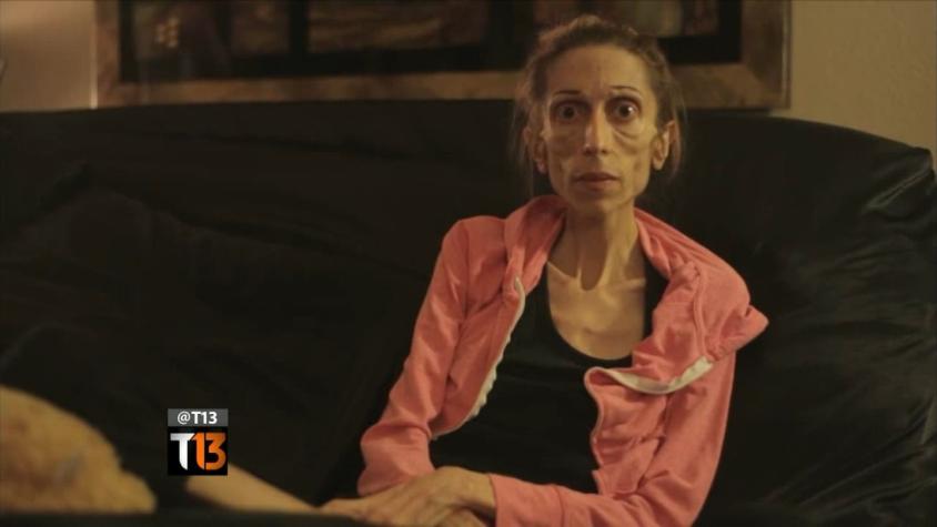 [VIDEO] Actriz con anorexia pide ayuda al mundo para poder vivir