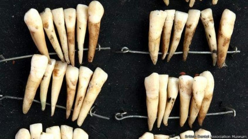 Los médicos que implantaban a los ricos los dientes de los muertos en Waterloo