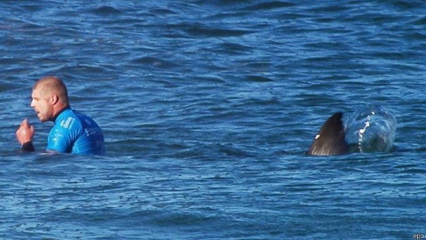 Surfista atacado por tiburón volverá a la tabla: "Darle la espalda al surf no sería buena elección"
