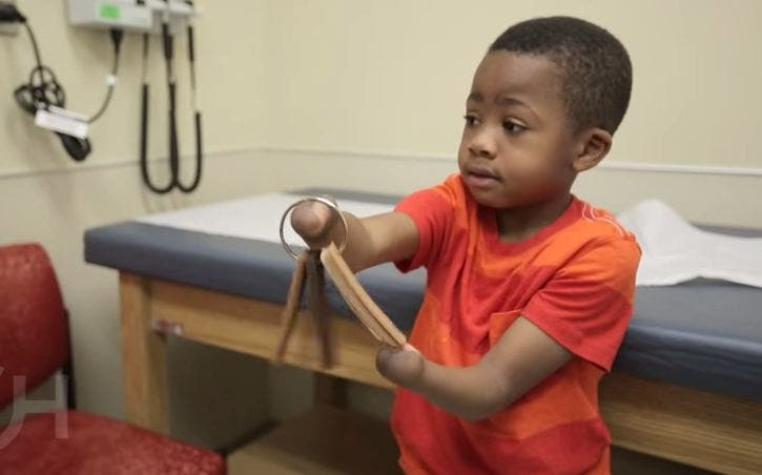 Zion Harvey, la historia del primer niño en recibir un trasplante doble de manos