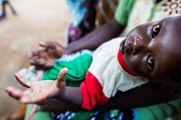 Más de 30.000 personas corren el riego de morir de hambre en Sudán del Sur