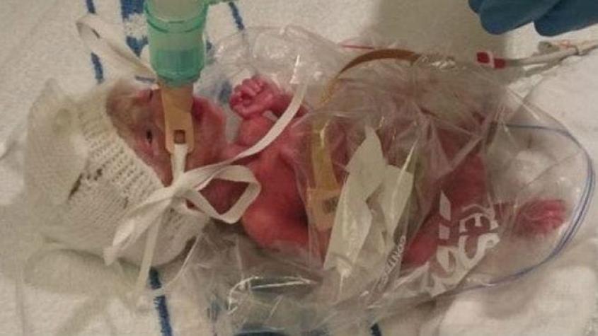 Los médicos que usaron una bolsa de sándwich para salvarle la vida a una bebé prematura