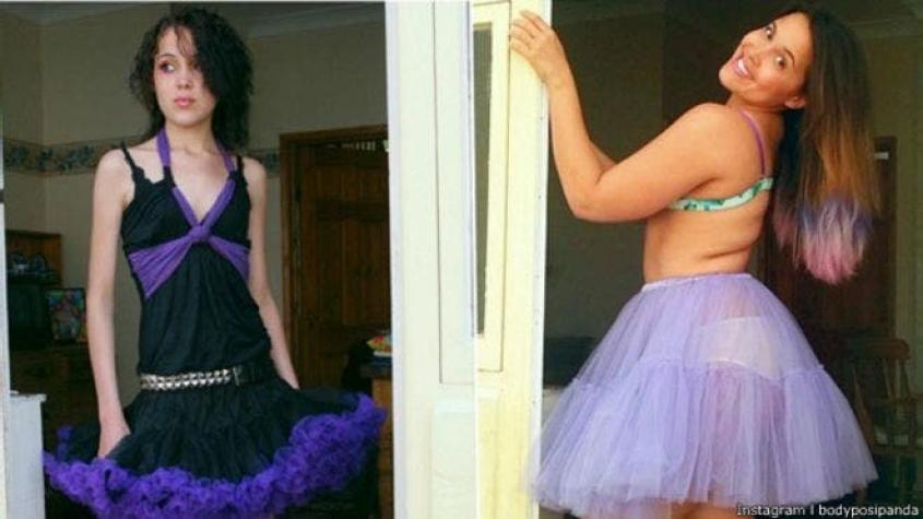 La joven ex anoréxica que muestra su recuperación en Instagram