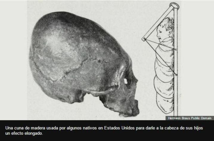 Por qué y cómo algunas culturas antiguas deformaban los cráneos de los bebés