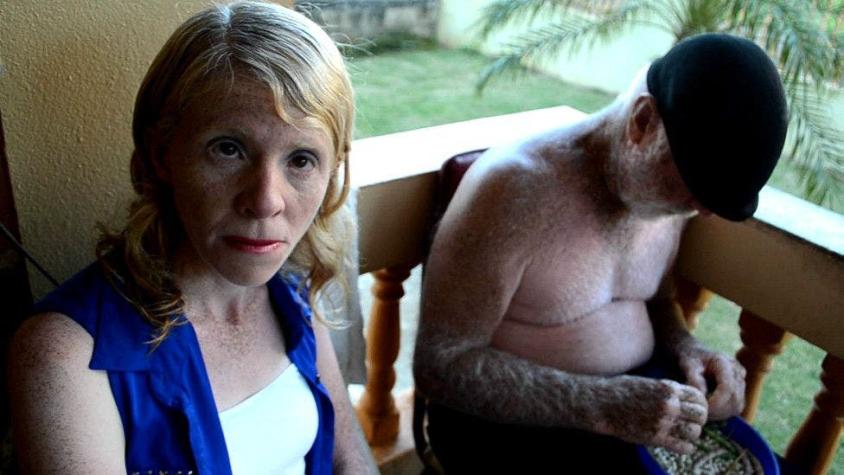 La conmovedora historia de la familia de albinos que vive en el encierro en Puerto Rico