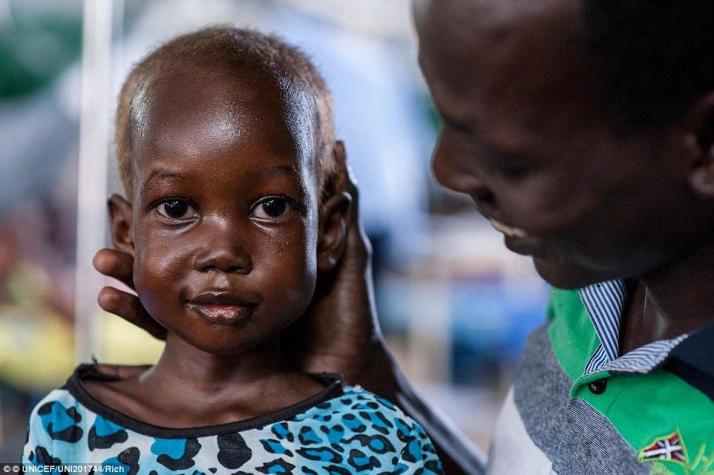 La niña desnutrida de Sudán del Sur que logró volver a ponerse de pie