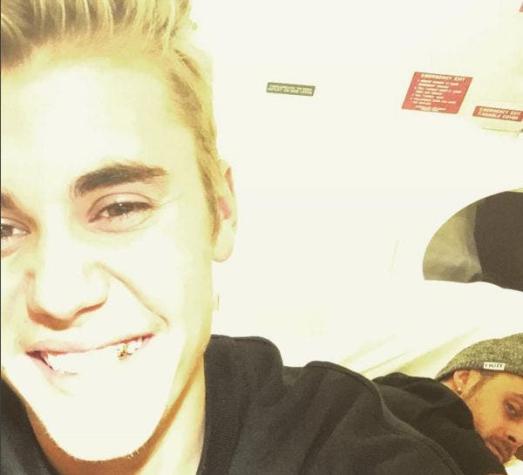 [VIDEO] El particular nuevo accesorio dental de Justin Bieber