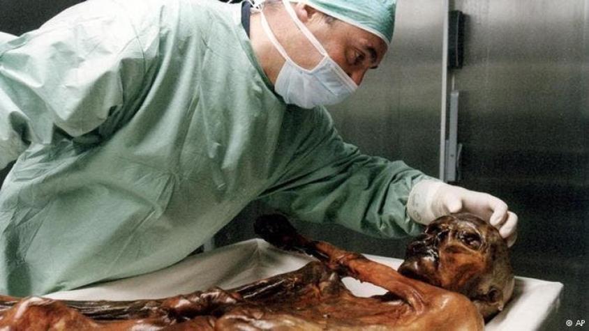 Momia Ötzi sufría de infección estomacal