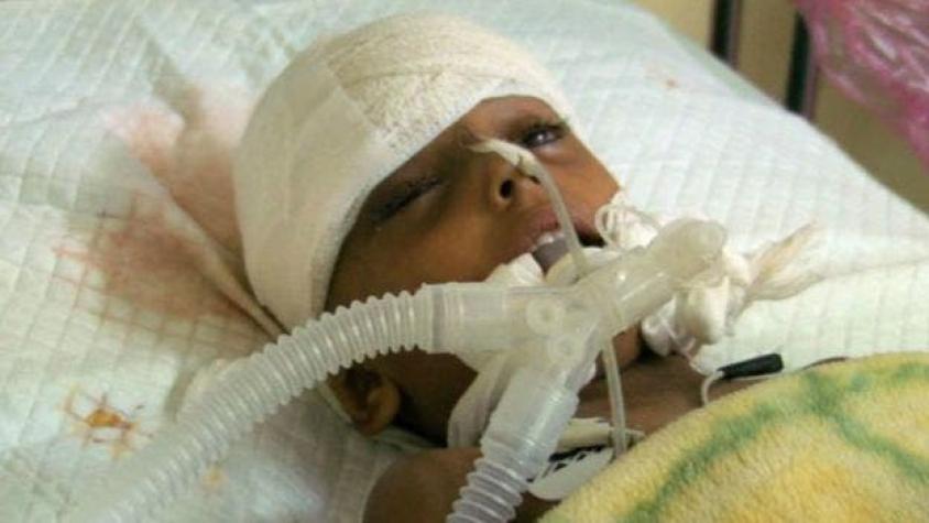 Yemen: la dramática historia de Asma, una niña atrapada en el horror de una guerra olvidada