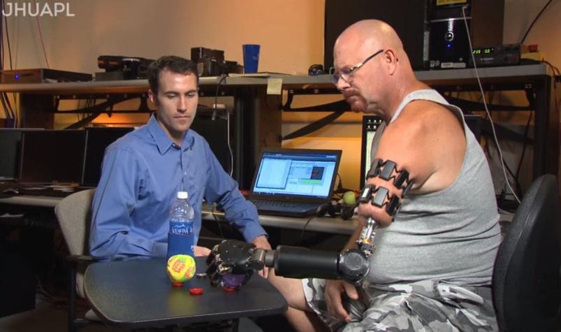 [VIDEO] Hombre puede controlar brazo biónico con su mente