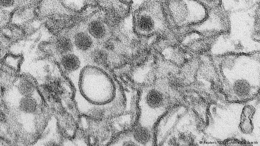 Registran primer caso de zika en China