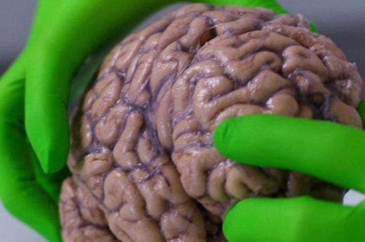 Lo que aprendí sosteniendo un cerebro humano en mis manos