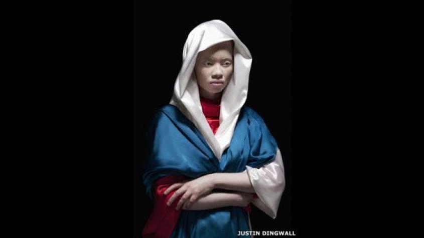 Fotógrafo retrata la belleza de los albinos