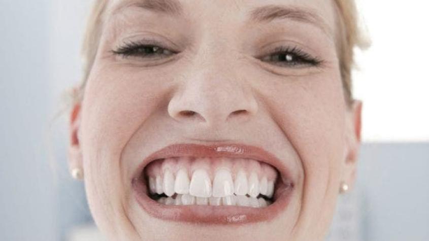 Dismorfia dental: la obsesión por tener una sonrisa perfecta