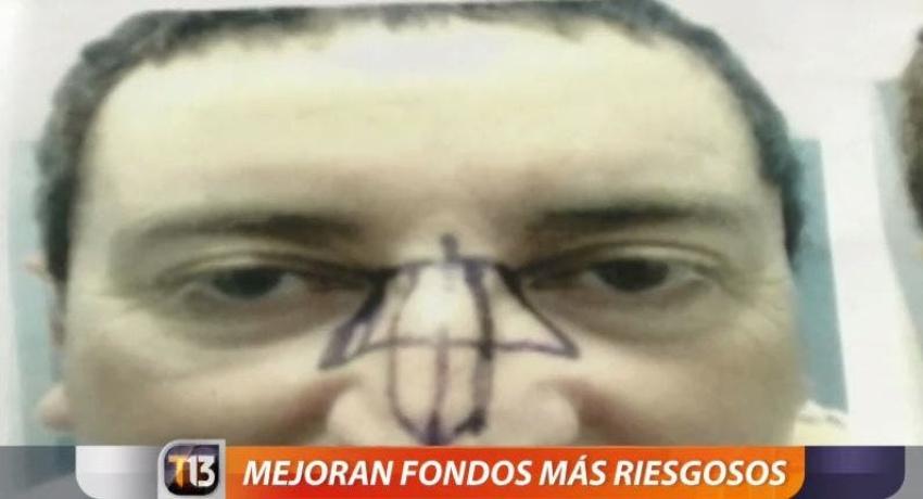 [VIDEO] Chileno se encuentra en estado grave tras operación en Tacna