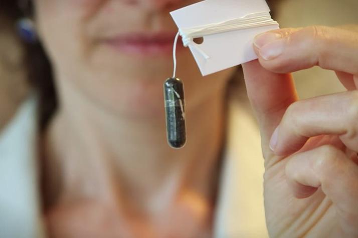 [VIDEO] La "citoesponja": un nuevo método para descubrir el cáncer de esófago