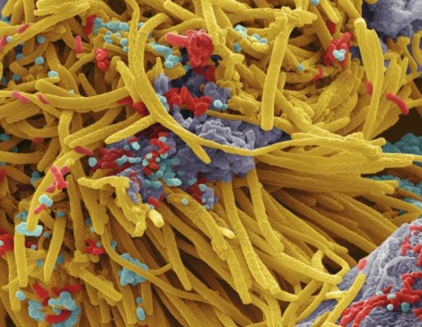 Las imágenes que revelan las bacterias que viven en nuestra boca