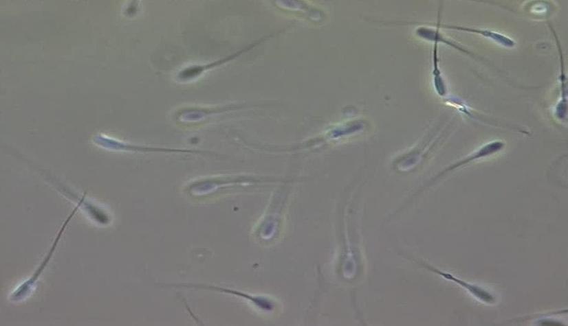 Crean espermatozoides humanos a partir de células de la piel